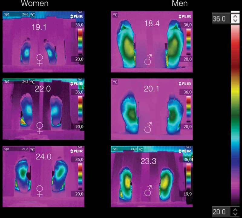 The thermoregulation of healthy individuals, overweight-obese, and diabetic from the plantar skin thermogram: a clue to predict the diabetic foot.