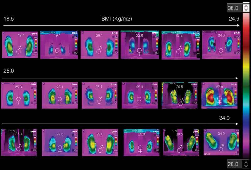 The thermoregulation of healthy individuals, overweight-obese, and diabetic from the plantar skin thermogram: a clue to predict the diabetic foot.