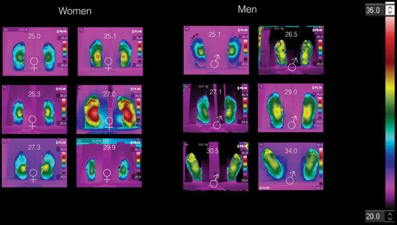 The thermoregulation of healthy individuals, overweight-obese, and diabetic from the plantar skin thermogram: a clue to predict the diabetic foot.