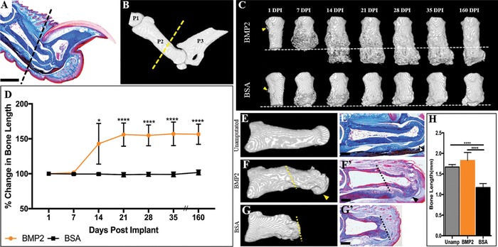 The periosteal requirement and temporal dynamics of BMP2-induced middle phalanx regeneration in the adult mouse.