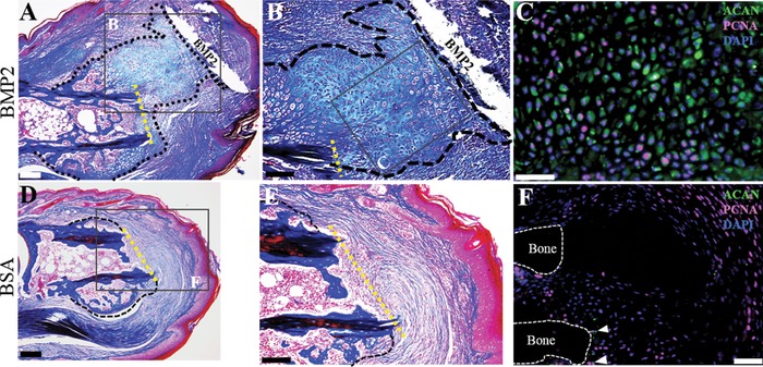 The periosteal requirement and temporal dynamics of BMP2-induced middle phalanx regeneration in the adult mouse.