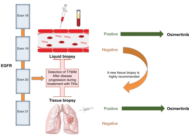 Osimertinib in the treatment of non-small-cell lung cancer: design, development and place in therapy.
