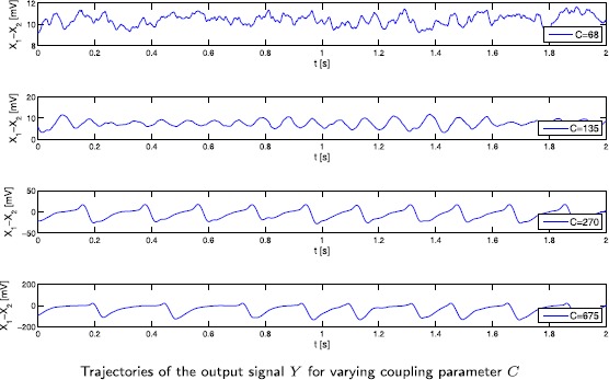 A Stochastic Version of the Jansen and Rit Neural Mass Model: Analysis and Numerics.