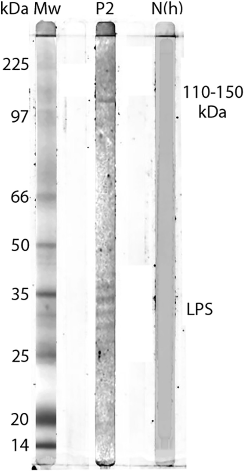 African tick bite fever in returning Swedish travellers. Report of two cases and aspects of diagnostics.
