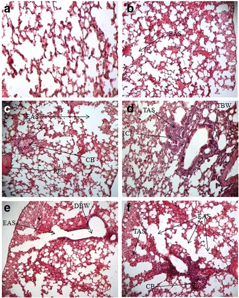 Biochemical and histological alterations induced by the smoke of allethrin based mosquito coil on mice model.