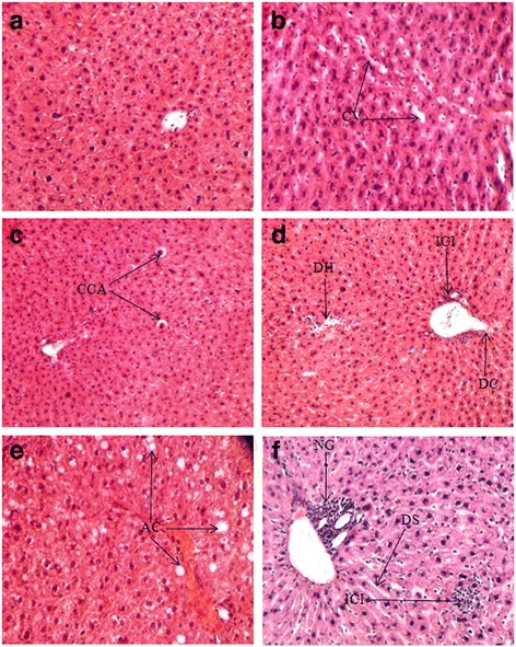 Biochemical and histological alterations induced by the smoke of allethrin based mosquito coil on mice model.