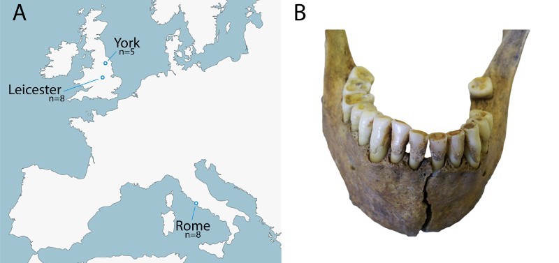 Preservation of the metaproteome: variability of protein preservation in ancient dental calculus.