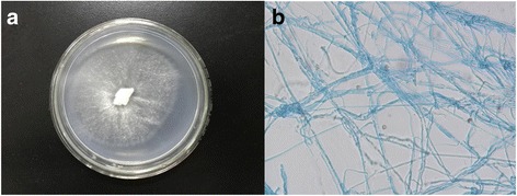 Genome sequence of the white-rot fungus <i>Irpex lacteus</i> F17, a type strain of lignin degrader fungus.