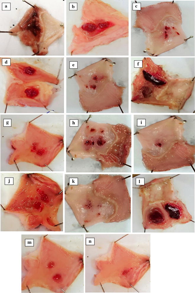 Synthesis, characterization, anti-ulcer action and molecular docking evaluation of novel benzimidazole-pyrazole hybrids.