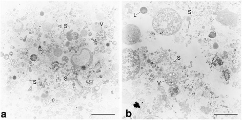Genome sequence of the sulfur-oxidizing <i>Bathymodiolus thermophilus</i> gill endosymbiont.