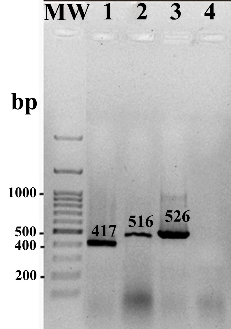 The Molecular Study of Antibiotic Resistance to Quinolones in <i>Salmonella enterica</i> Strains Isolated in Tehran, Iran.