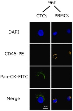 Evaluation of a simple method for storage of blood samples that enables isolation of circulating tumor cells 96 h after sample collection.