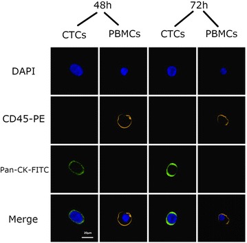 Evaluation of a simple method for storage of blood samples that enables isolation of circulating tumor cells 96 h after sample collection.