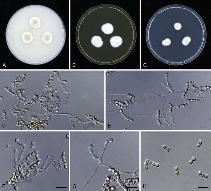 Scopulariopsis and scopulariopsis-like species from indoor environments