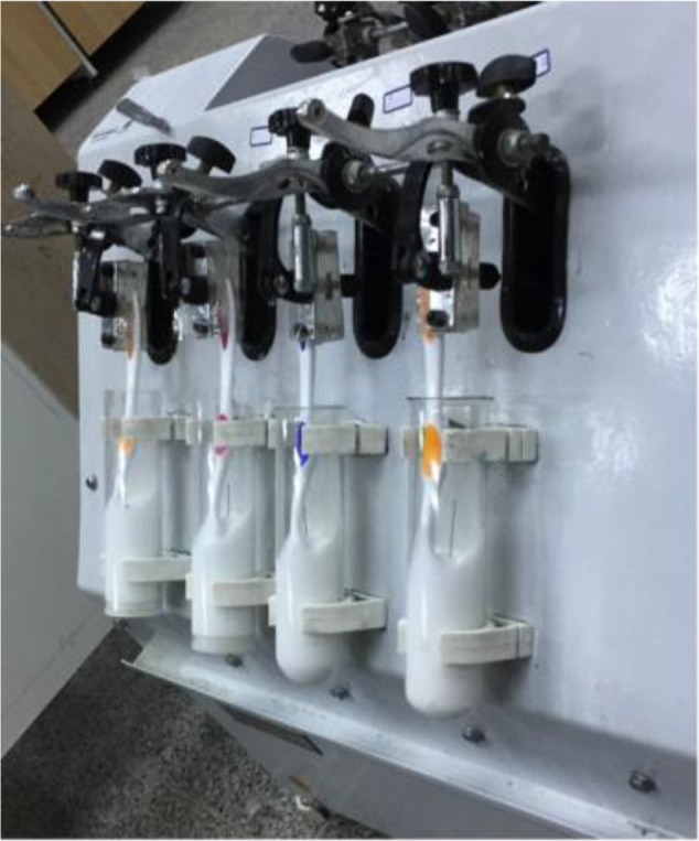 Effect of Different Types of Toothpaste on the Frictional Resistance Between Orthodontic Stainless Steel Brackets and Wires.