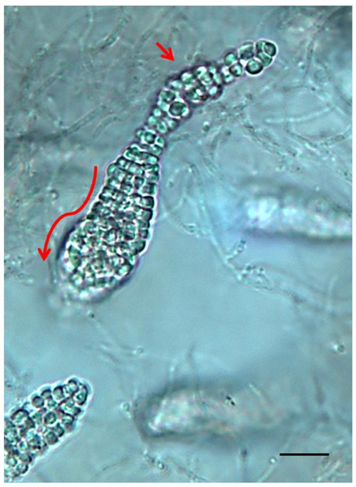 Permanent Draft Genome sequence for <i>Frankia</i> sp<i>.</i> strain CcI49, a Nitrogen-Fixing Bacterium Isolated from <i>Casuarina cunninghamiana</i> that Infects <i>Elaeagnaceae</i>.