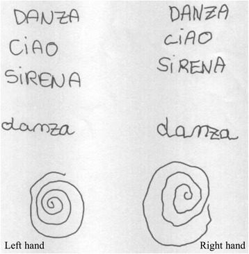 Hemicerebellitis can drive handedness shift.