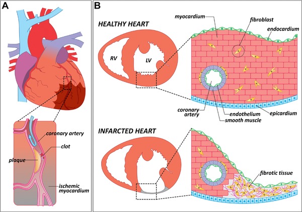 Zebrafish heart regeneration: 15 years of discoveries.