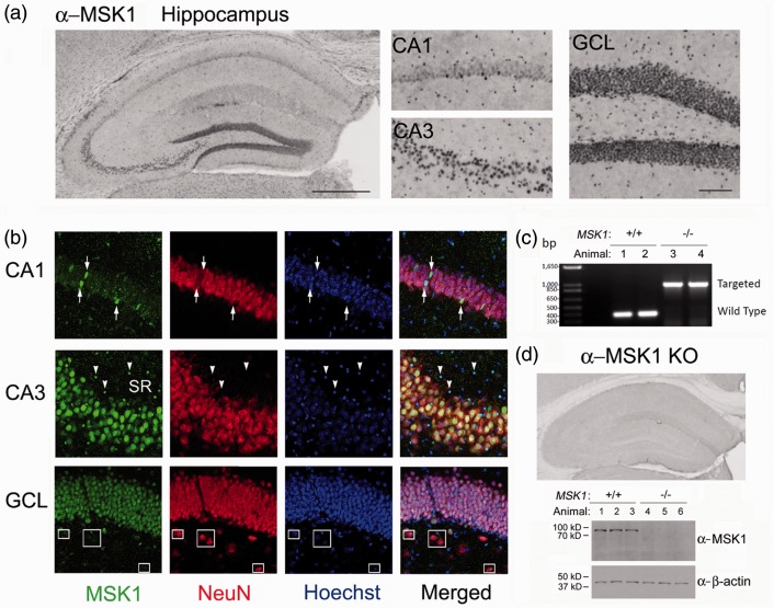 Mitogen- and Stress-Activated Protein Kinase 1 Regulates Status Epilepticus-Evoked Cell Death in the Hippocampus.