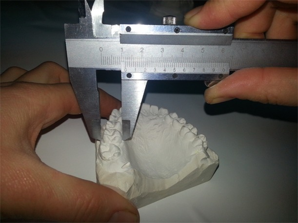 Sex differences of odontometrical indexes crowns of molars.