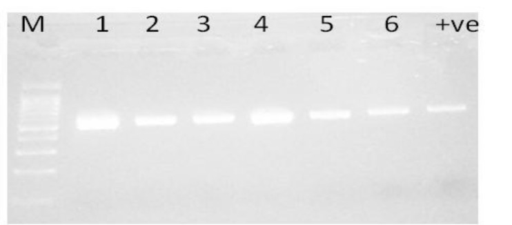 Co-Occurrence of Plasmid-Mediated AmpC β-Lactamase Activity Among <i>Klebsiella pneumoniae</i> and <i>Escherichia Coli</i>.