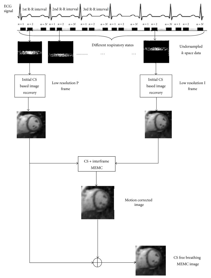 Respiratory Motion Correction for Compressively Sampled Free Breathing Cardiac MRI Using Smooth <i>l</i><sub>1</sub>-Norm Approximation.