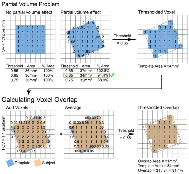 Automated Voxel Placement: A Linux-based Suite of Tools for Accurate and Reliable Single Voxel Coregistration.