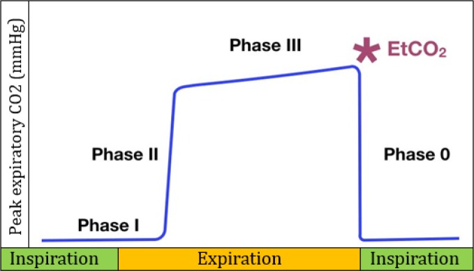 Applications of End-Tidal Carbon Dioxide (ETCO2) Monitoring in Emergency Department; a Narrative Review.