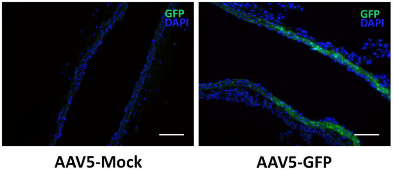 Introducing a Novel Method of Intravascular Adeno-associated Virus-mediated Gene Delivery.