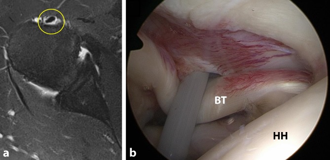 Nonoperative treatment of five common shoulder injuries: A critical analysis.