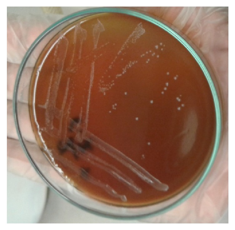 Molecular Detection of <i>Brucella</i> spp. from Milk of Seronegative Cows from Some Selected Area in Bangladesh.