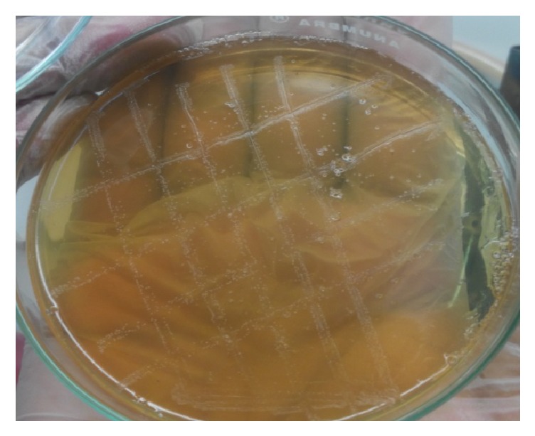 Molecular Detection of <i>Brucella</i> spp. from Milk of Seronegative Cows from Some Selected Area in Bangladesh.