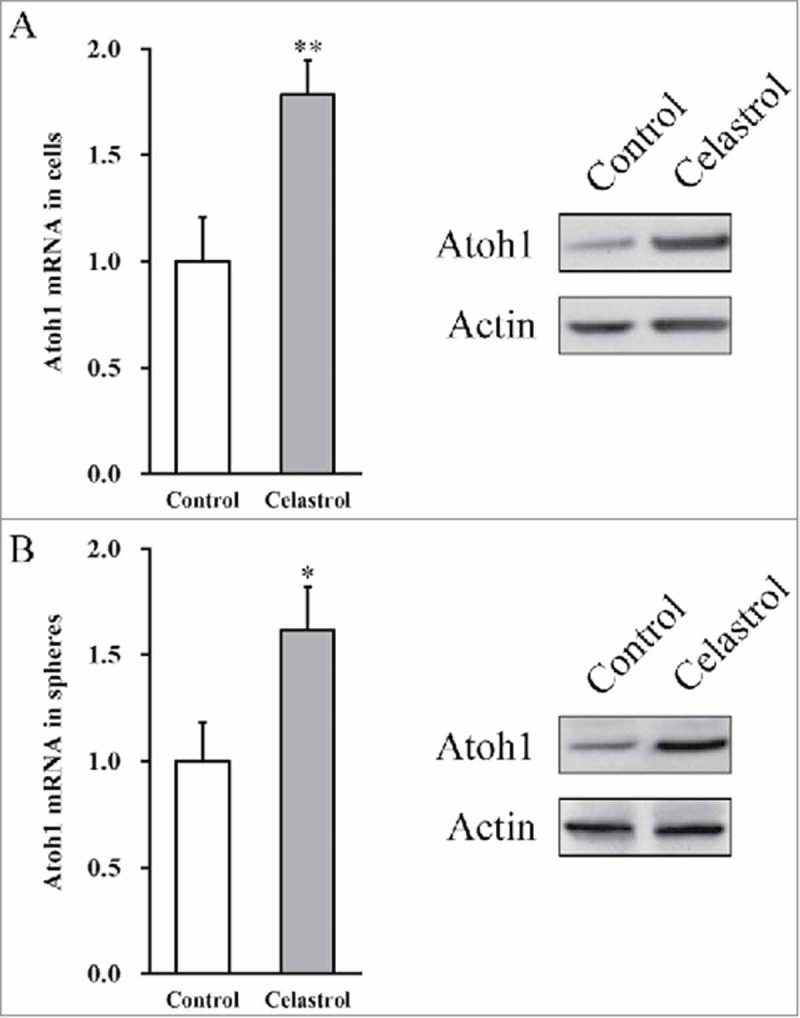 Celastrol enhances Atoh1 expression in inner ear stem cells and promotes their differentiation into functional auditory neuronal-like cells.