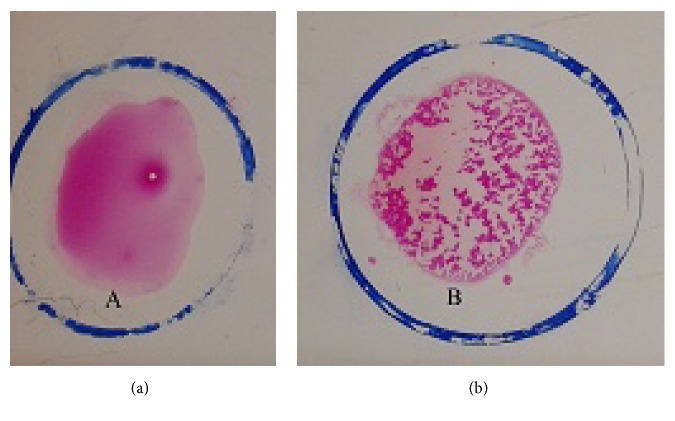 Molecular Detection of <i>Brucella</i> spp. from Milk of Seronegative Cows from Some Selected Area in Bangladesh.