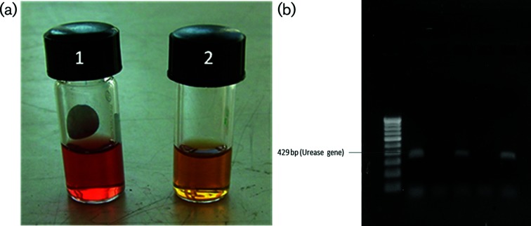 A case of oropharyngeal <i>Ureaplasma urealyticum</i> infection in a human immunodeficiency virus positive bisexual male co-infected with human papilloma virus and <i>Treponema pallidum</i>.