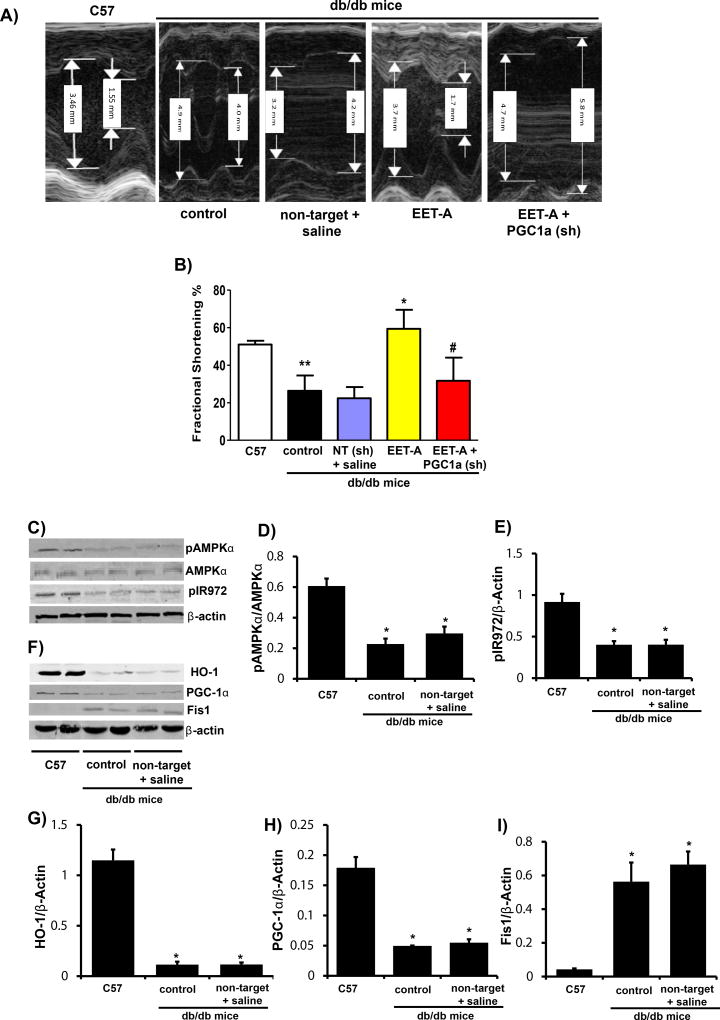 CYP-450 Epoxygenase Derived Epoxyeicosatrienoic Acid Contribute To Reversal of Heart Failure in Obesity-Induced Diabetic Cardiomyopathy <i>via</i> PGC-1 <i>α</i> Activation.