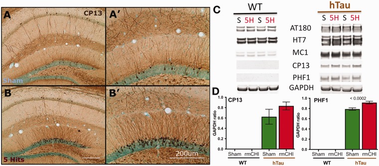 Repeated Mild Closed Head Injuries Induce Long-Term White Matter Pathology and Neuronal Loss That Are Correlated With Behavioral Deficits.