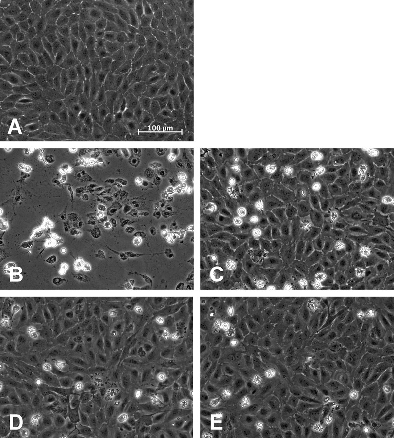 Serum- and albumin-free cryopreservation of endothelial monolayers with a new solution.