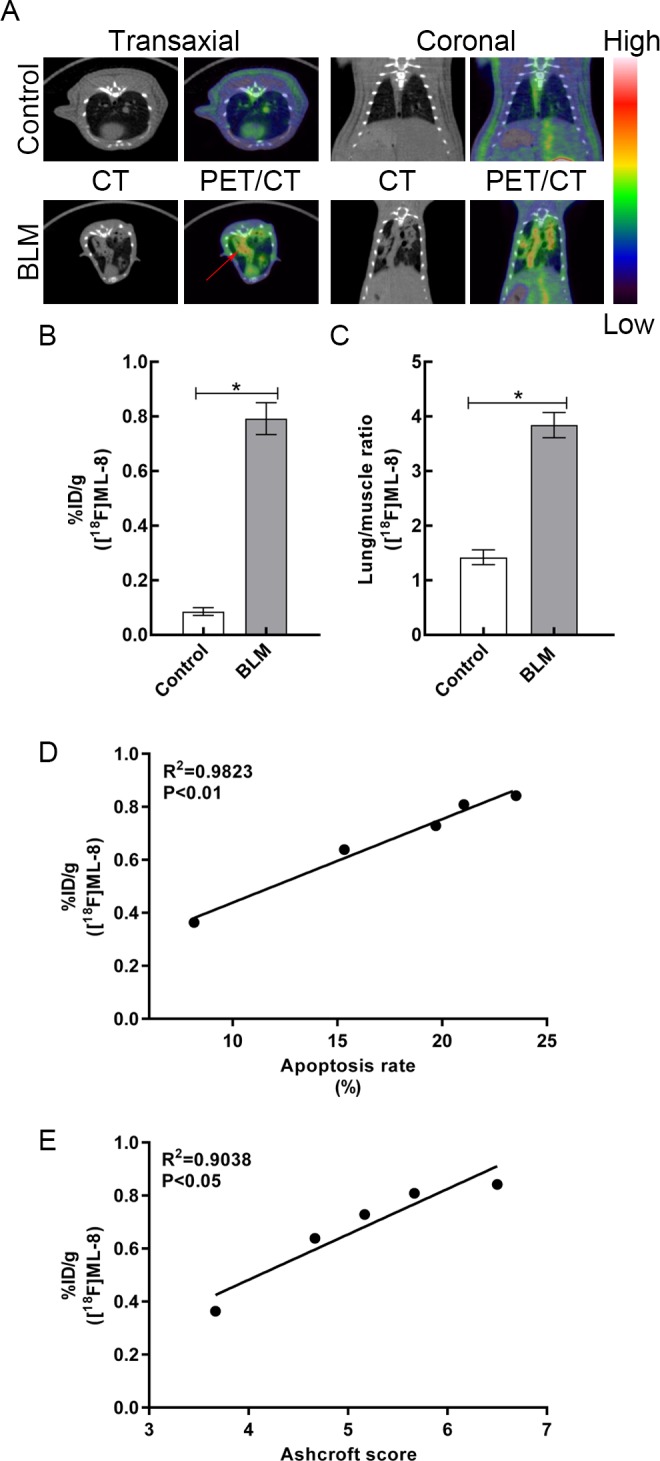 Apoptotic PET Imaging of Rat Pulmonary Fibrosis With [<sup>18</sup>F]ML-8.