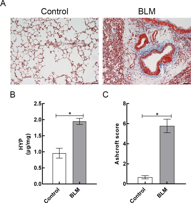 Apoptotic PET Imaging of Rat Pulmonary Fibrosis With [<sup>18</sup>F]ML-8.