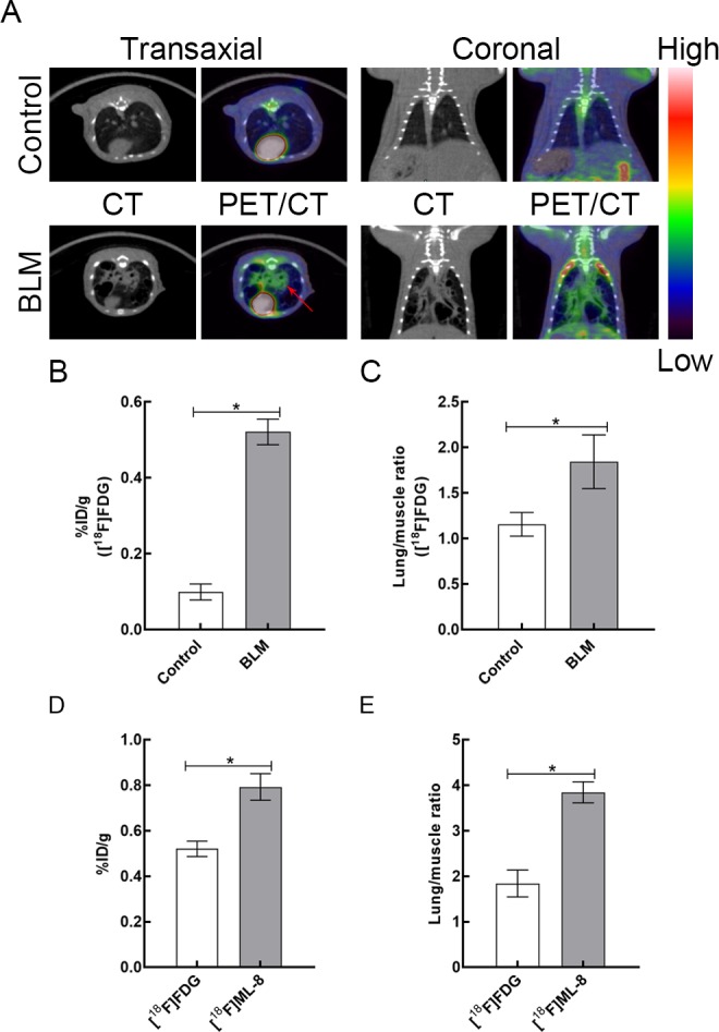 Apoptotic PET Imaging of Rat Pulmonary Fibrosis With [<sup>18</sup>F]ML-8.