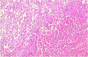 The expression of MDM2 in gastrointestinal stromal tumors: immunohistochemical analysis of 35 cases.