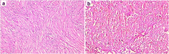 The expression of MDM2 in gastrointestinal stromal tumors: immunohistochemical analysis of 35 cases.