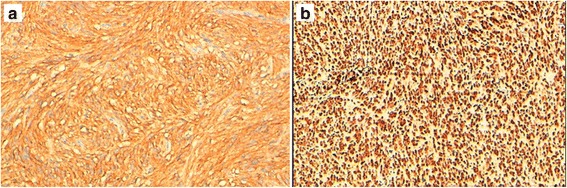 The expression of MDM2 in gastrointestinal stromal tumors: immunohistochemical analysis of 35 cases.