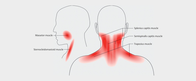 Reference Values for Shear Wave Elastography of Neck and Shoulder Muscles in Healthy Individuals.