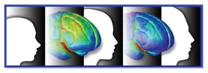 NIH's Adolescent Brain Cognitive Development (ABCD) Study.