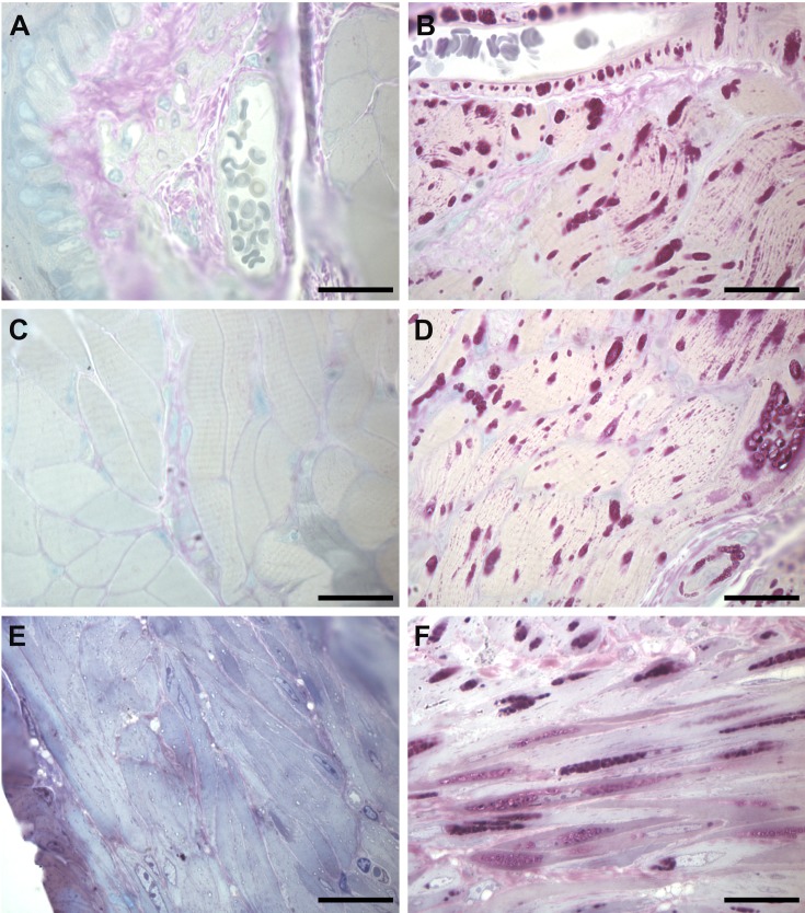 The impact of Pompe disease on smooth muscle: a review.