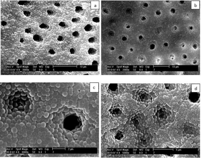 Minimum Intracanal Dressing Time of Triple Antibiotic Paste to Eliminate Enterococcus Faecalis (ATCC 29212) and Determination of Minimum Inhibitory Concentration and Minimum Bactericidal Concentration: An Ex Vivo Study.