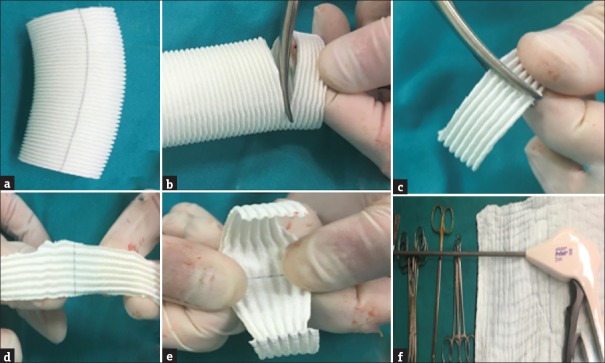 An Alternative Technique in the Control of Massive Presacral Rectal Bleeding: Fixation of GORE-TEX<sup>®</sup> Aortic Patch.