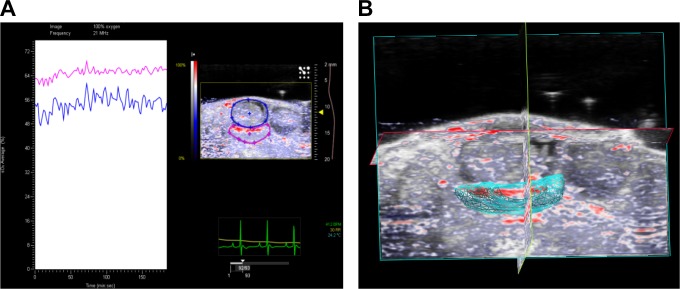 Preclinical Ultrasound-Guided Photoacoustic Imaging of the Placenta in Normal and Pathologic Pregnancy.